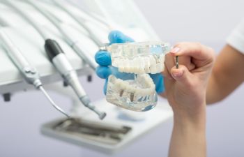 Dental implants visualization