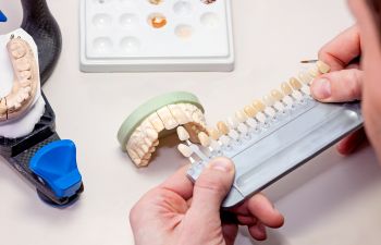 Dental implants visualization