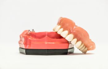 Dental implants visualization