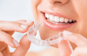 Invisalign