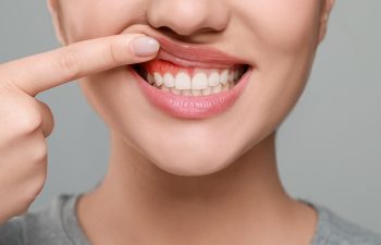 Woman showing inflamed gum on grey background, closeup, 